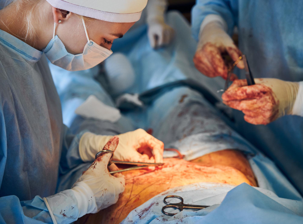 tar-surgery