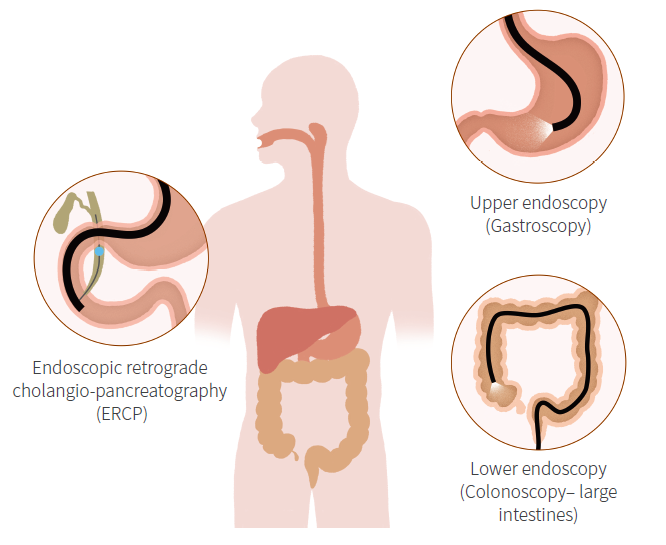 best endoscopy doctor in mumbai