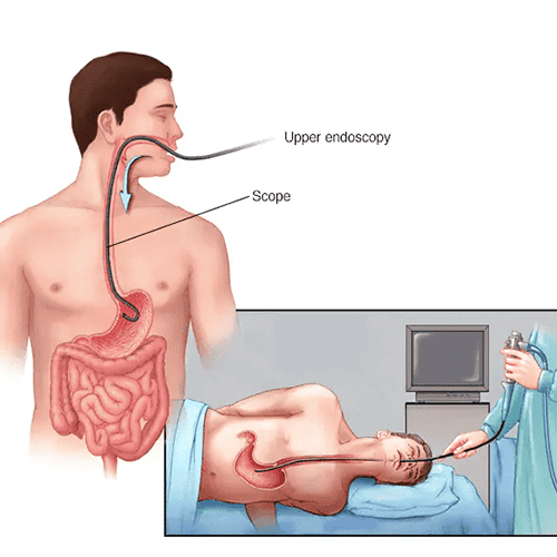 endoscopy in mumbai